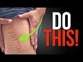 How To Massage Your Scar After Knee Replacement