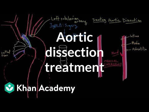 Aortic dissection treatment | Circulatory System and Disease | NCLEX-RN | Khan Academy