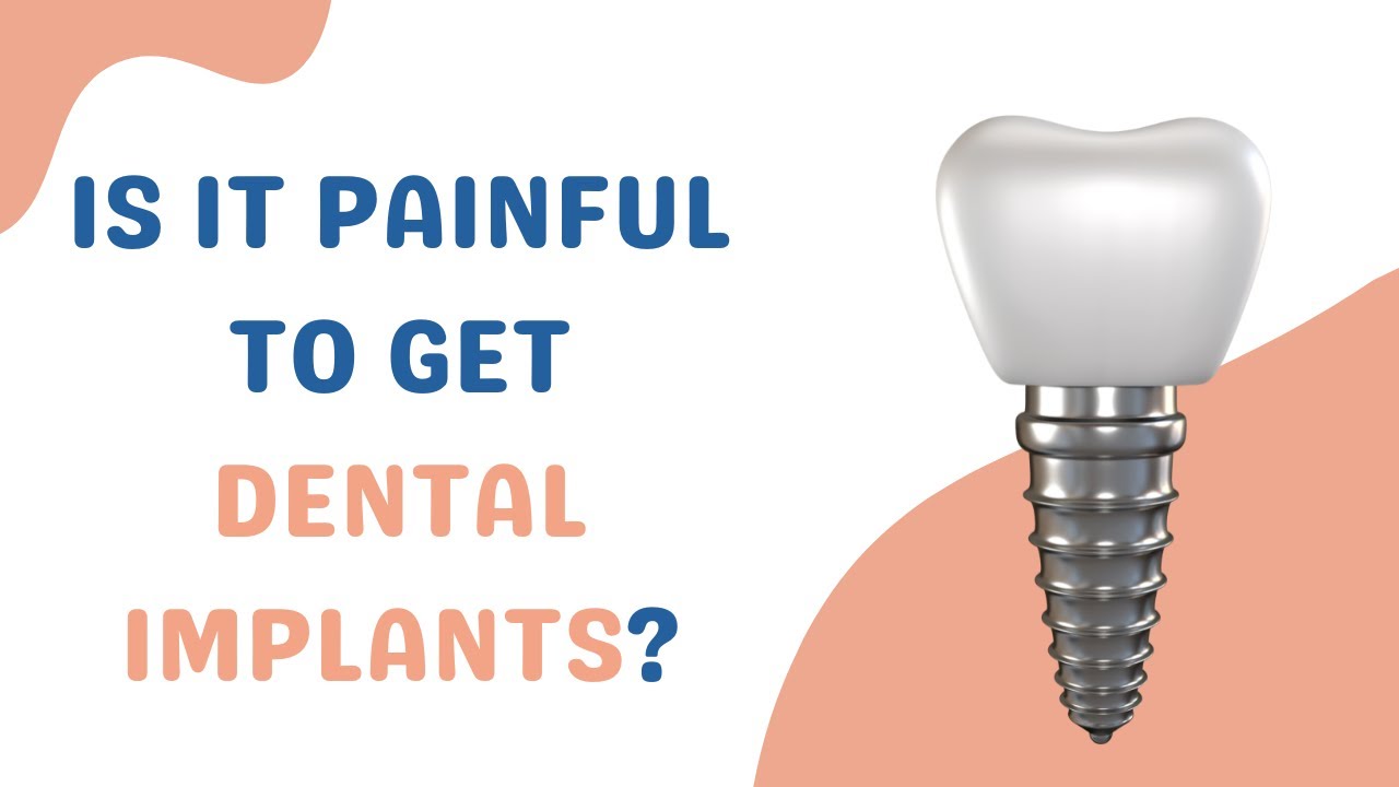 Implant Myths!