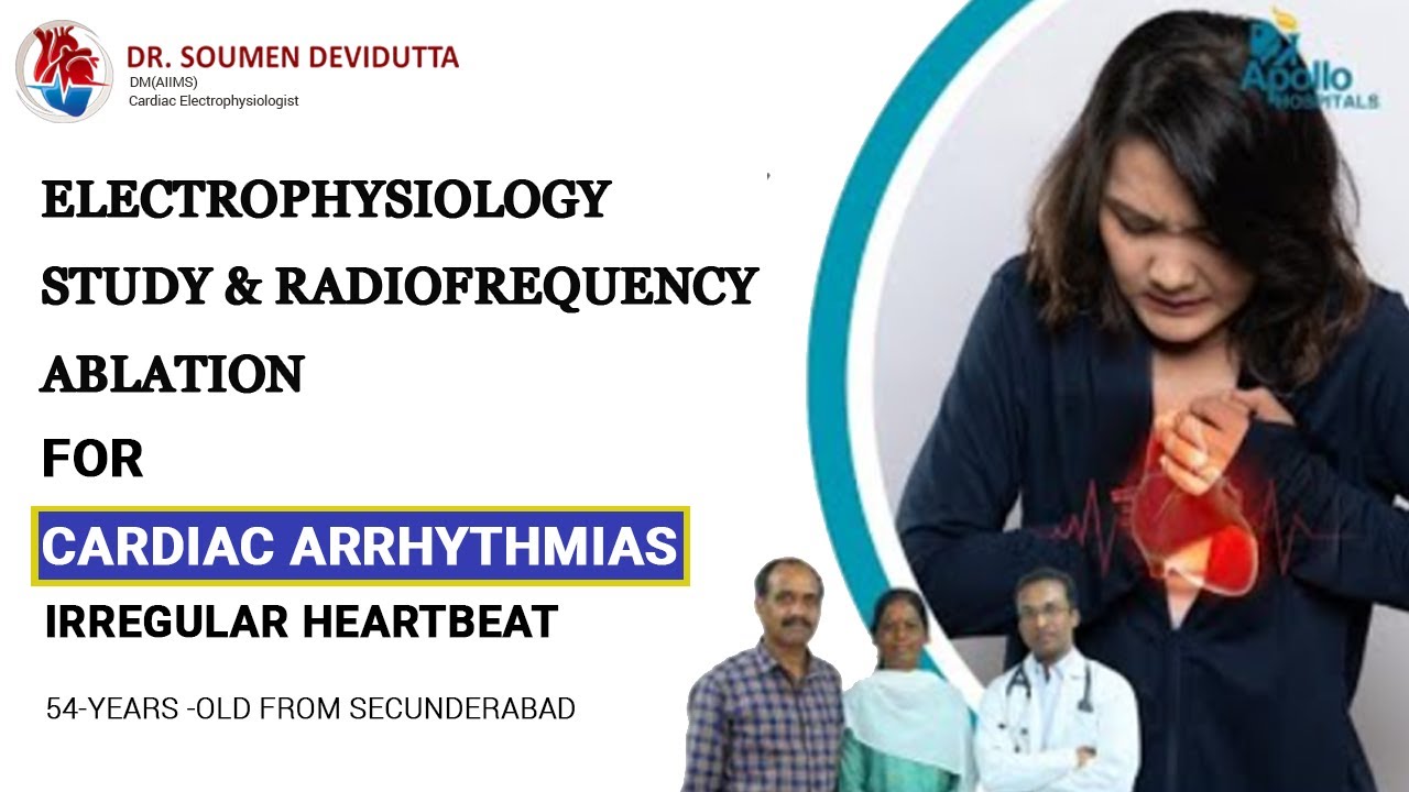 54 Yr Old Recovered From Cardiac Arrhythmias With Electrophysiology Study & Radiofrequency Ablation
