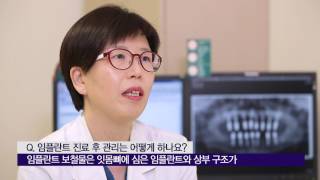 임플란트 진료 후 관리는 어떻게 하나요? 미리보기