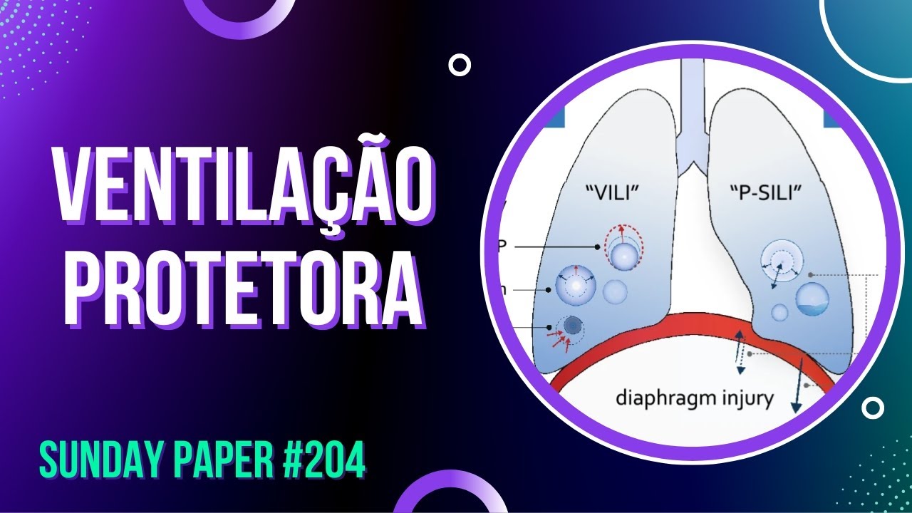 Estratégia Protetora de Ventilação na SDRA #204 - SUNDAY PAPER | Ivens Giacomassi