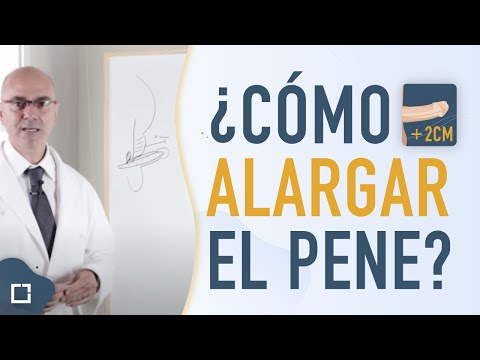 Che è possibile aumentare la potenza Pepe è utile per la potenza