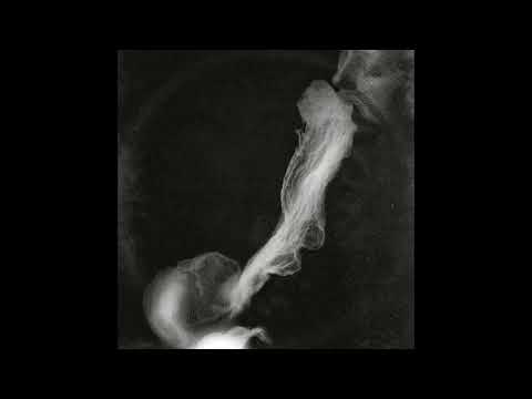 DUS - Ectoplasm Feat. Eto