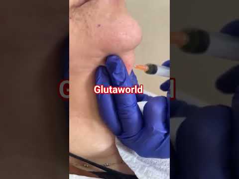 Glutathione Injection
