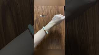 IV Whitening in Poipet