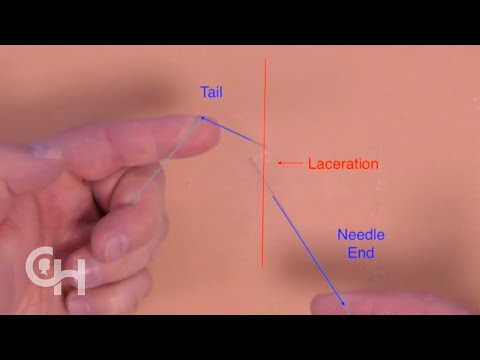 Suture Basics: One- Hand Knot Tie, Left Hand