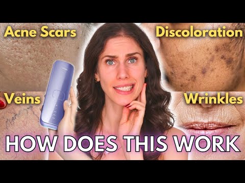 IPL "Hair Removal" Does More than Just Remove Hair... (Intense Pulsed Light / Home Hair Removal)