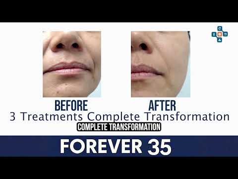 Transformation Campaign