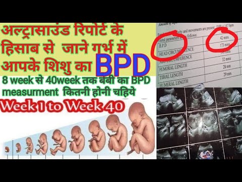 foetal BPD parameter measurements week by week in ultrasound/what is BPD