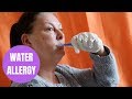 Woman With Water Allergy So Rare The Smallest Drop Of Liquid Causes Her Skin To Break
