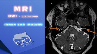 Download lagu MRI – DWI – INNER EAR IMAGING mp3