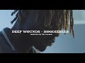 Hoodiebeeb Deep Wounds