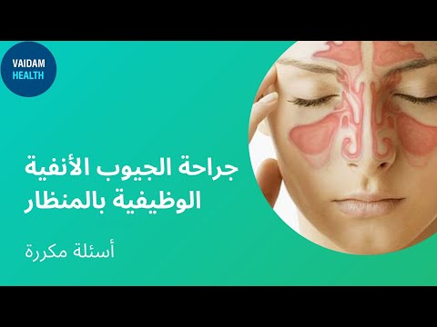 أسئلة يتكرر طرحها عن FESS - جراحة الجيوب الأنفية بالمنظار