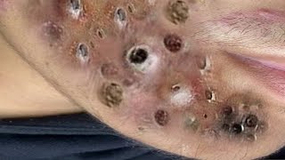 طرق حماية بشرة الوجهCC8000