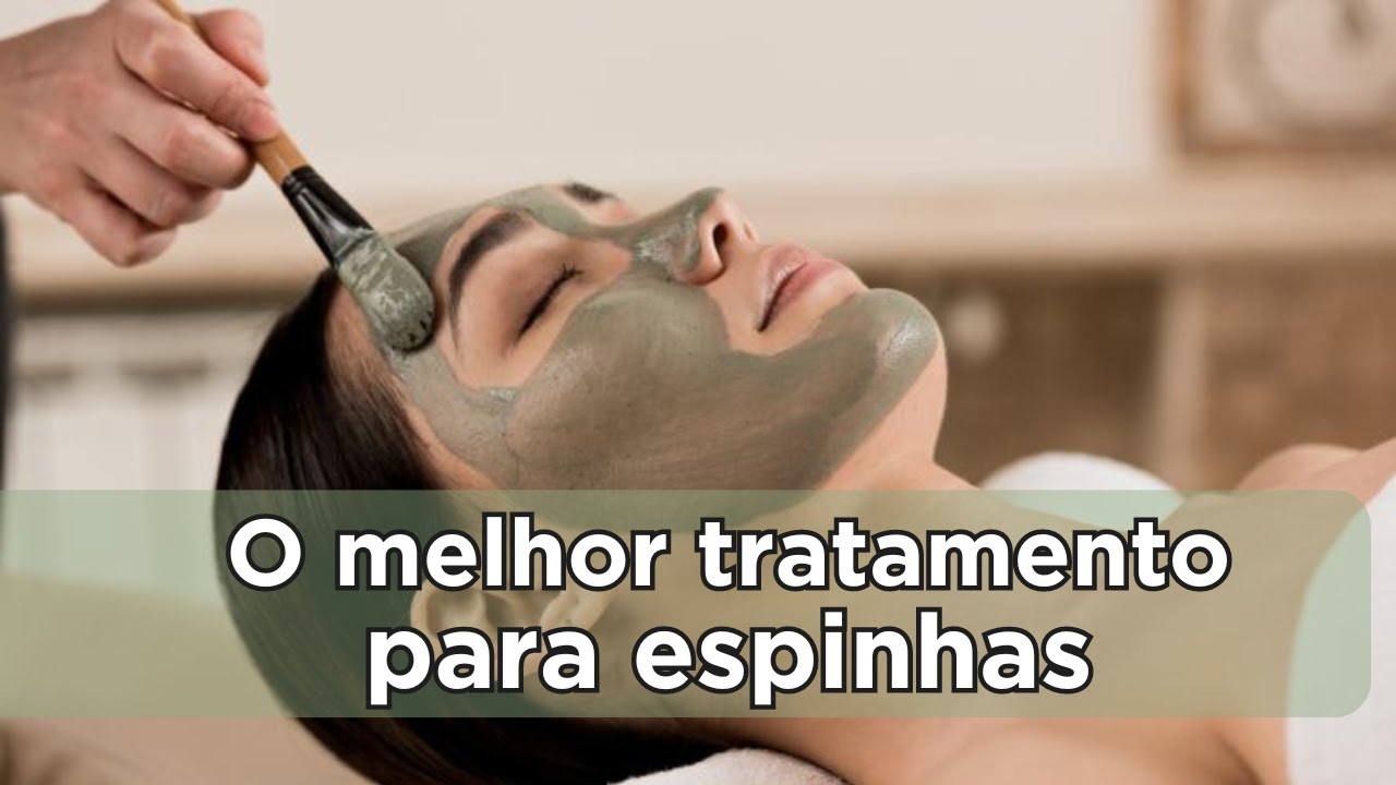 O melhor tratamento para espinhas com Estética Natural