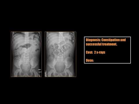Pediatric Abdominal Imaging, Dr. David Dansie