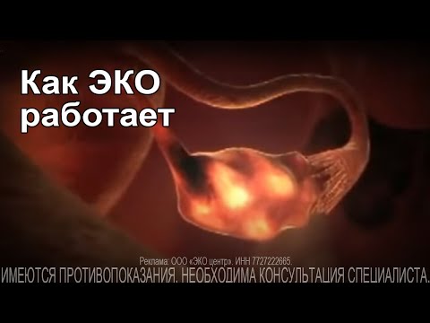 Превью видео на тему Пузырный занос при ЭКО