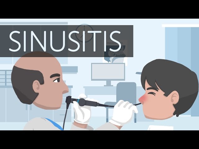 Video Uitspraak van sinusitis in Engels