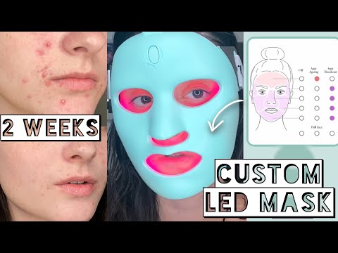 I TESTED A CUSTOM LED MASK ON MY ACNE FOR 2 WEEKS | The Ultimate Skin Treatment?! | Qure Mask Review