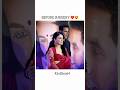 She Before Surgery But After Radhikamadan Shorts Editing Youtubeshorts