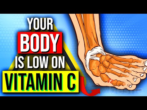 DON'T IGNORE These 10 Signs - You May Be VITAMIN C DEFICIENT!