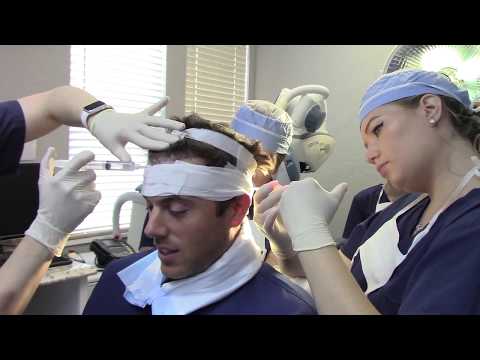 What is the NeoGraft FUE Hair Transplant System