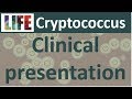 Cryptococcosis: clinical presentation