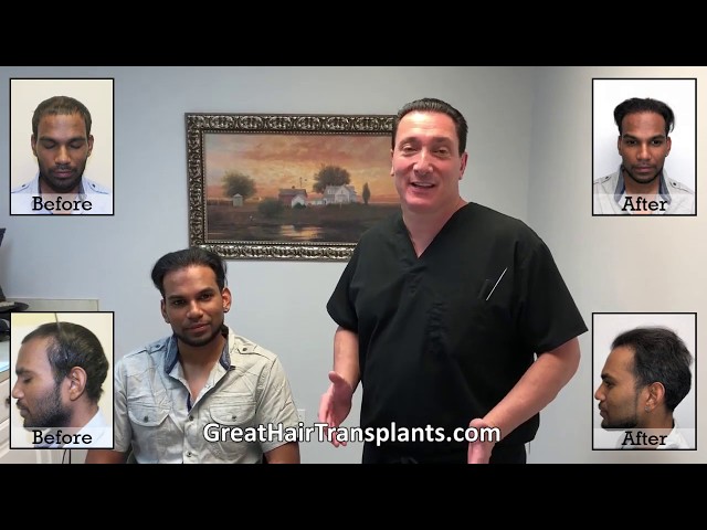  Dr. Brett Bolton Patient Davindra MaxHarvest&trade; Plus Procedure

