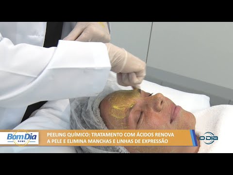 Peeling químico: Tratamento com ácidos renova pele, elimina manchas e linhas de expressão 17 03 2022