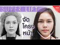 ร้อยไหม คอ ล ลา เจน