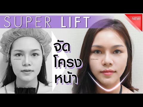 ร้อยไหม คอ ล ลา เจน