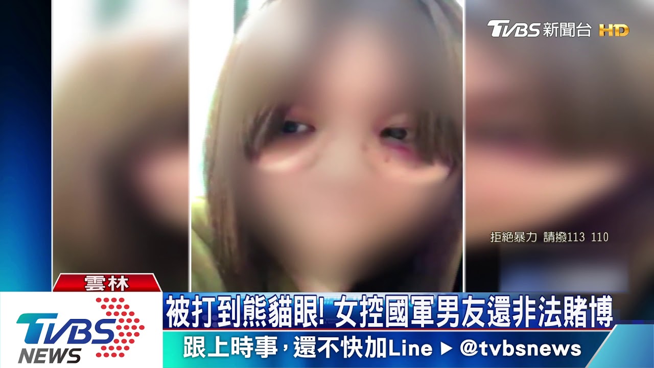 被打到熊貓眼! 女控國軍男友還非法賭