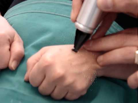 A me caccia di una lentiggine Quale probabilità della nascita del bambino senza lentiggini se alla donna