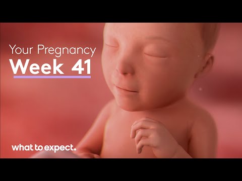 41 Weeks Pregnant - What to Expect