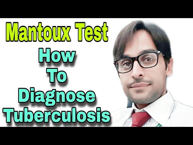 Video Pronunciation of mantoux test in English