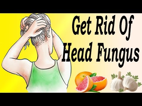 Clinic para sa paggamot ng kuko Bawang sa paggamot ng kuko halamang-singaw