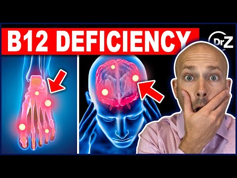 Vitamin B12 Deficiency Symptoms That You Must Know About