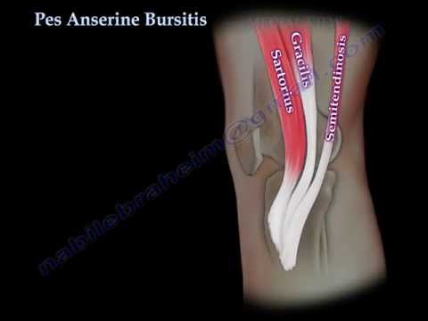 Pes Anserine Bursitis , knee pain  - Everything You Need To Know - Dr. Nabil Ebraheim