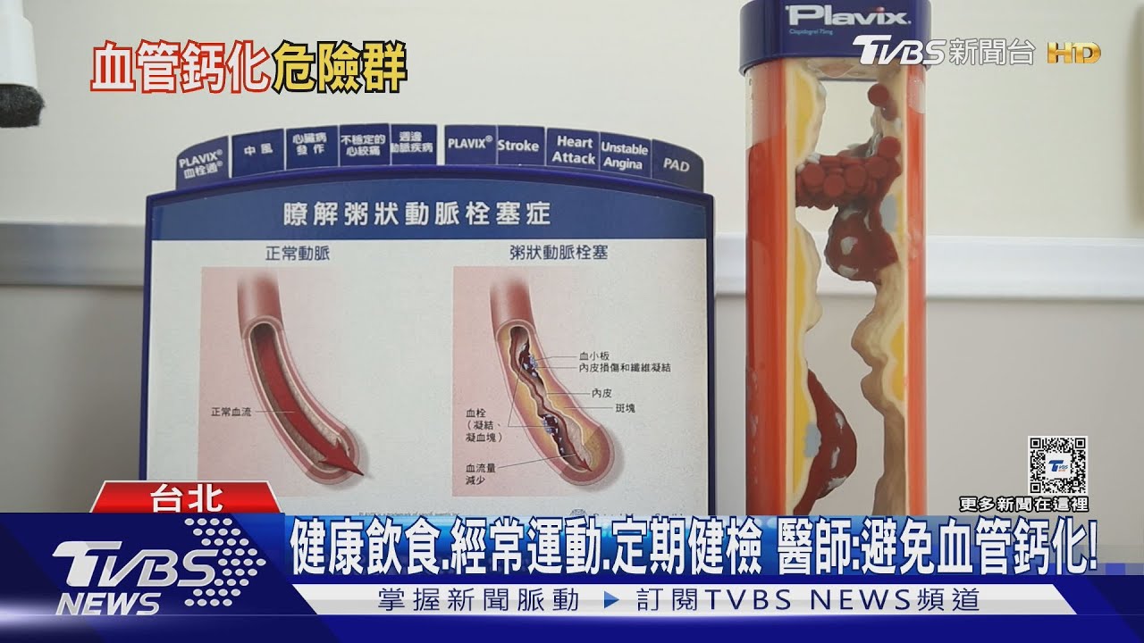 不重視這「三大保健秘訣」!血管出現鈣質堆積 醫師:未來致死風險高