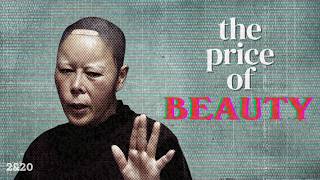 Why Plastic Surgery Is Destroying Korea MQDEFAULT Thumbnail