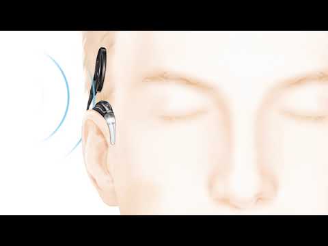 Cochlear Implant Nucleus 9