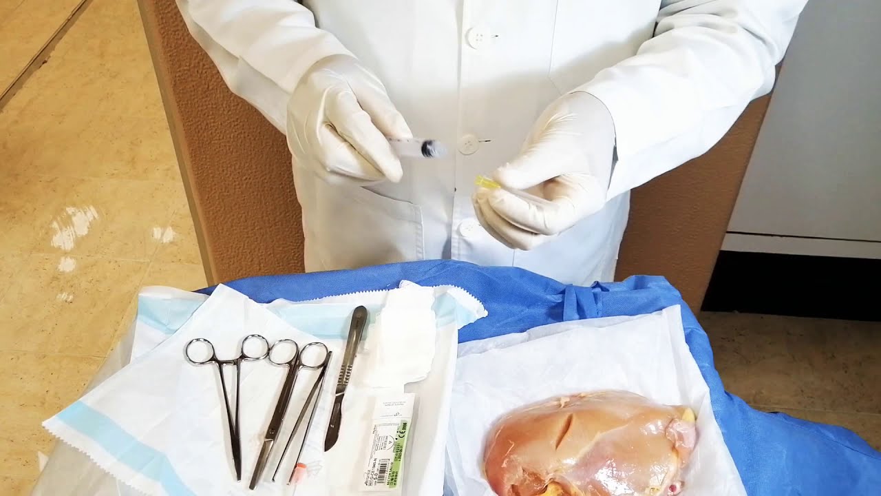 Técnica para Cargar Anestésico Local (Lidocaina). NUNCA CON EPINEFRINA EN DEDOS OREJA PENE ETC**