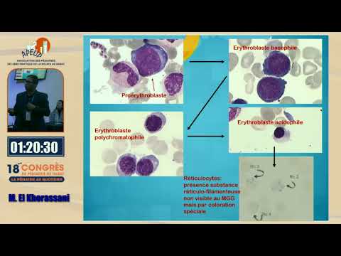 Atelier : Lecture de l'hémogramme et la place du frottis sanguin.  M. Khorassani