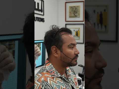 Video de paciente