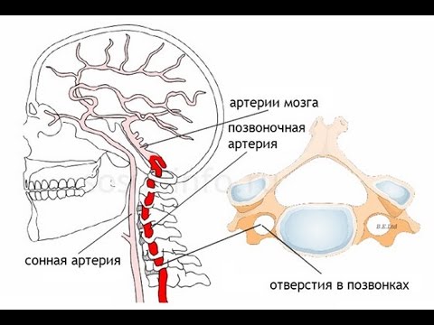 Артроз коленного сустава с кистой Боль в пояснице справа при движении