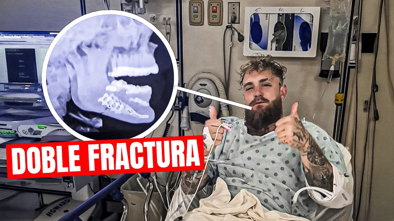 JAKE PAUL DOBLE FRACTURA de MANDÍBULA!