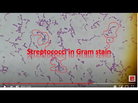 Streptococcus agalactiae