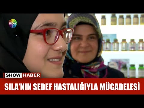 Sıla'nın sedef hastalığıyla mücadelesi