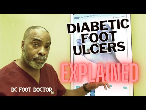 Diabetic Foot Ulcers Explained